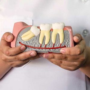 Problematic Wisdom Teeth