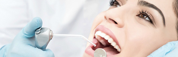 dental-whitening-treatment