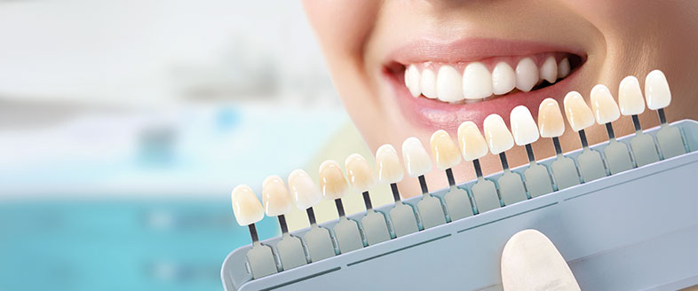 Teeth Whitening Options