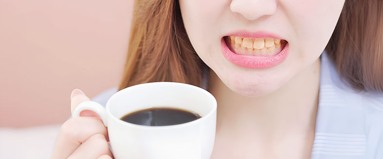 Coffee Stained Teeth