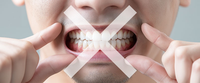 Dangers to Teeth Whitening